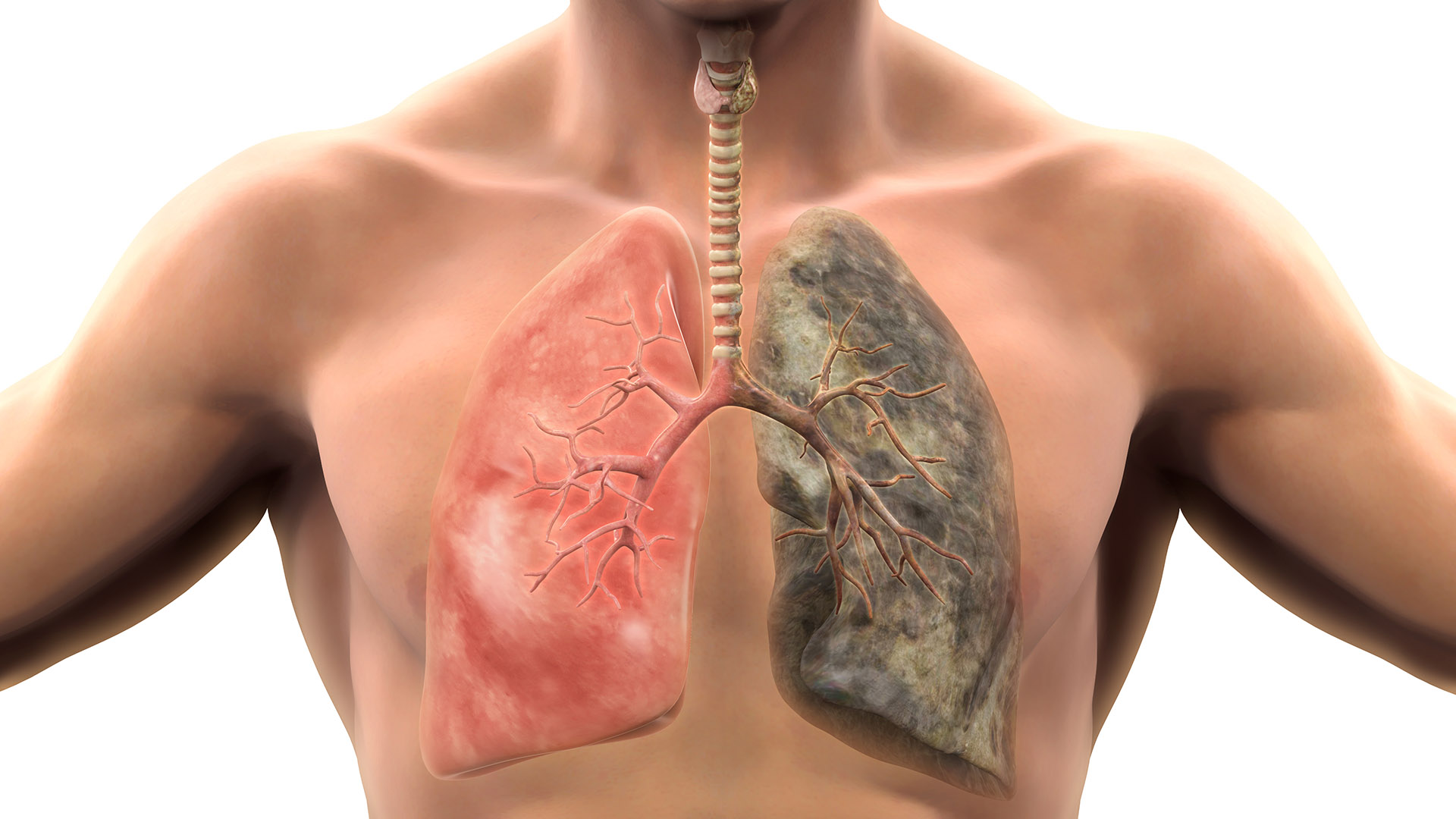 ¿Puede la IA puede detectar el cáncer de pulmón de manera rápida y confiable?