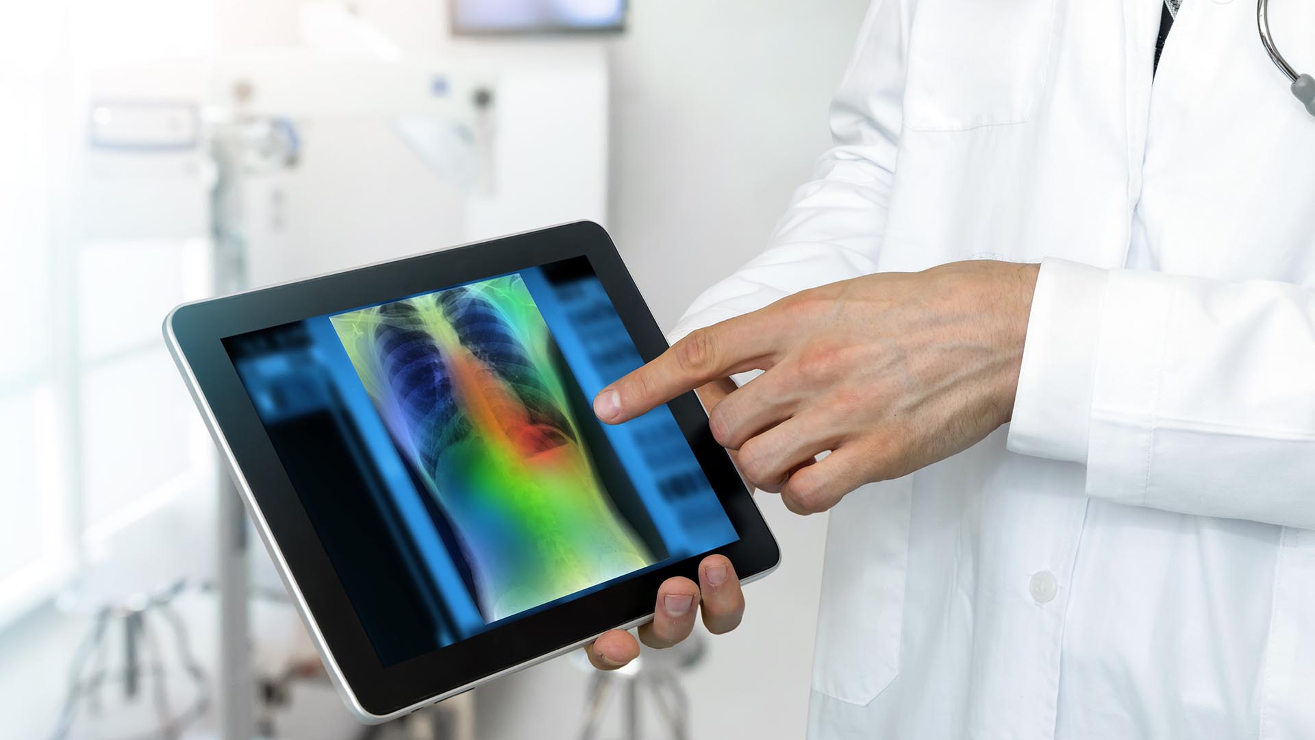 Inteligencia artificial en la detección de cáncer: ¿puede ayudar a salvar vidas?